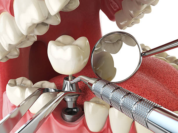 Best Urgent Care for Lost Fillings or Crowns in Benton, AR